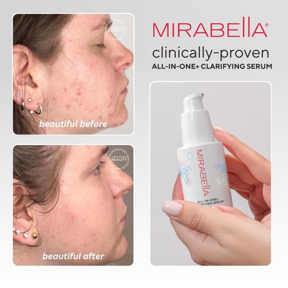 Mirabella All in One Oil-Free Hydrating Serum NEW $58 - Picture 7 of 14